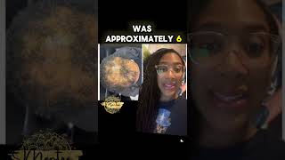 CCCA Hair Loss Treatment in Black Patients | PRF + PDGF Therapy Explained