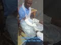 Casing This Man's Amputated Hand