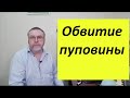 Обвитие пуповины. Почему возникает, чем опасно, и что делать?