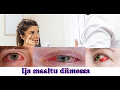 DIIMACHUU IJAA