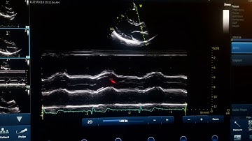 m-mode general conception