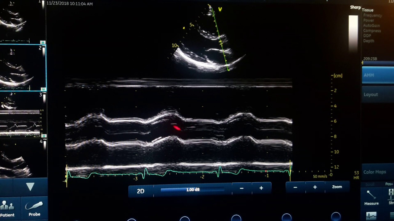 общая концепция m-режима