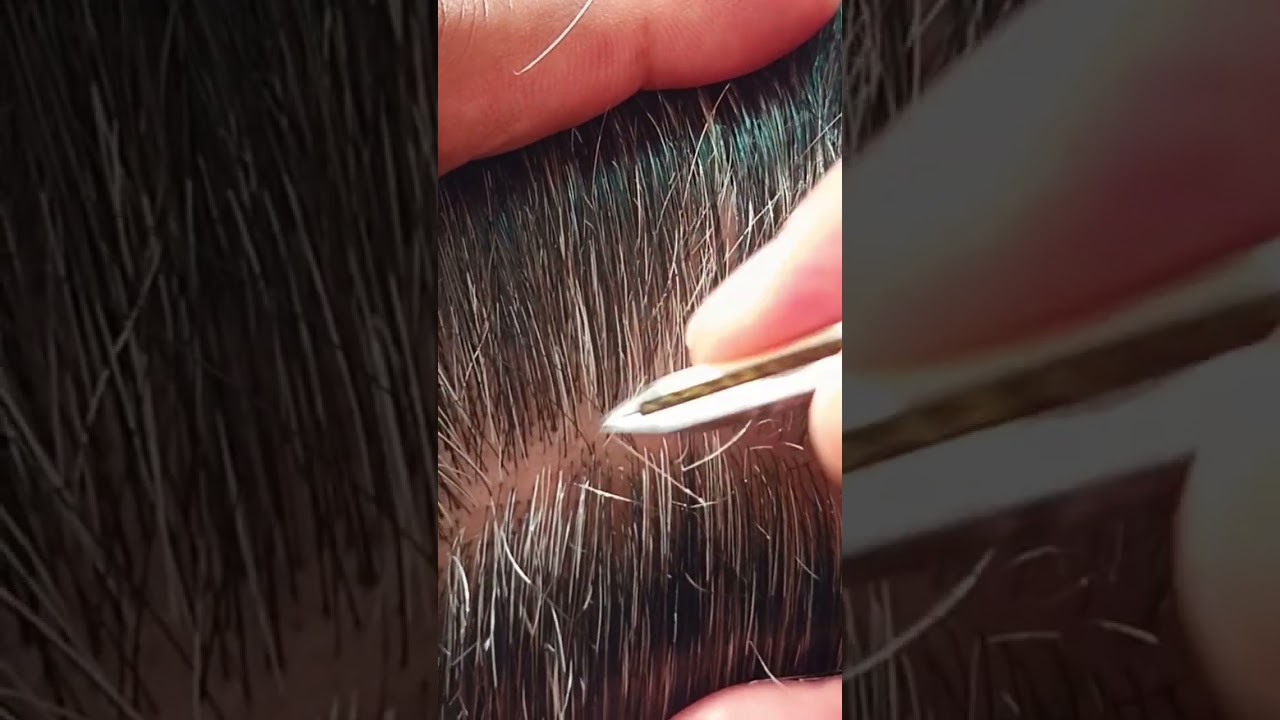 Самое приятное удаление седых волос #57 