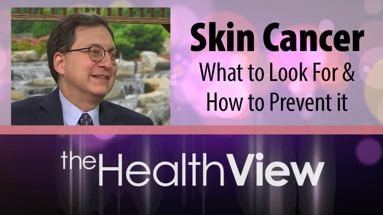 Skin Cancer What To Look For And How To Prevent It Youtube