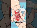 Cómo separan los médicos a gemelos siameses unidos por la espalda 👶⚕️ #animacion #2dshow #salud