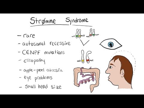 Video: Vai Dauna sindroms rodas mitozē vai meiozē?
