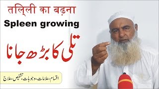 Spleen Growing || تلی کا بڑھ جانے کا علاج  || |तिल्ली का बढ़ना ||  Al Huda Guidance