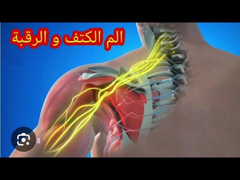 الم الرقبة والكتف رقبة ولا كتف الم الكتف والرقبة