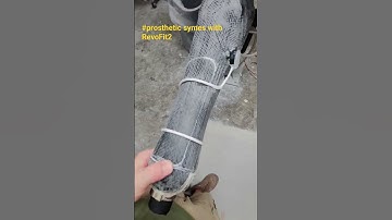 #Prosthetic Symes with revofit2