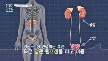 주변에 흔하면서 전신 질환을 일으키는 무서운 질병 ?? 