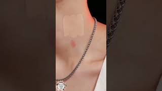 love bite hack foundation