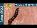 #22 Pull Out Beard(Viewpoint of Pores), Blackhead and Hair Root(Root Sheath) Close up