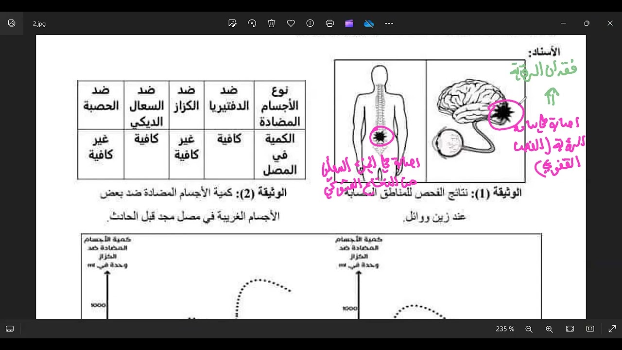 حل وضعية ادماجية حول المناعة و الاتصال العصبي رابعة متوسط