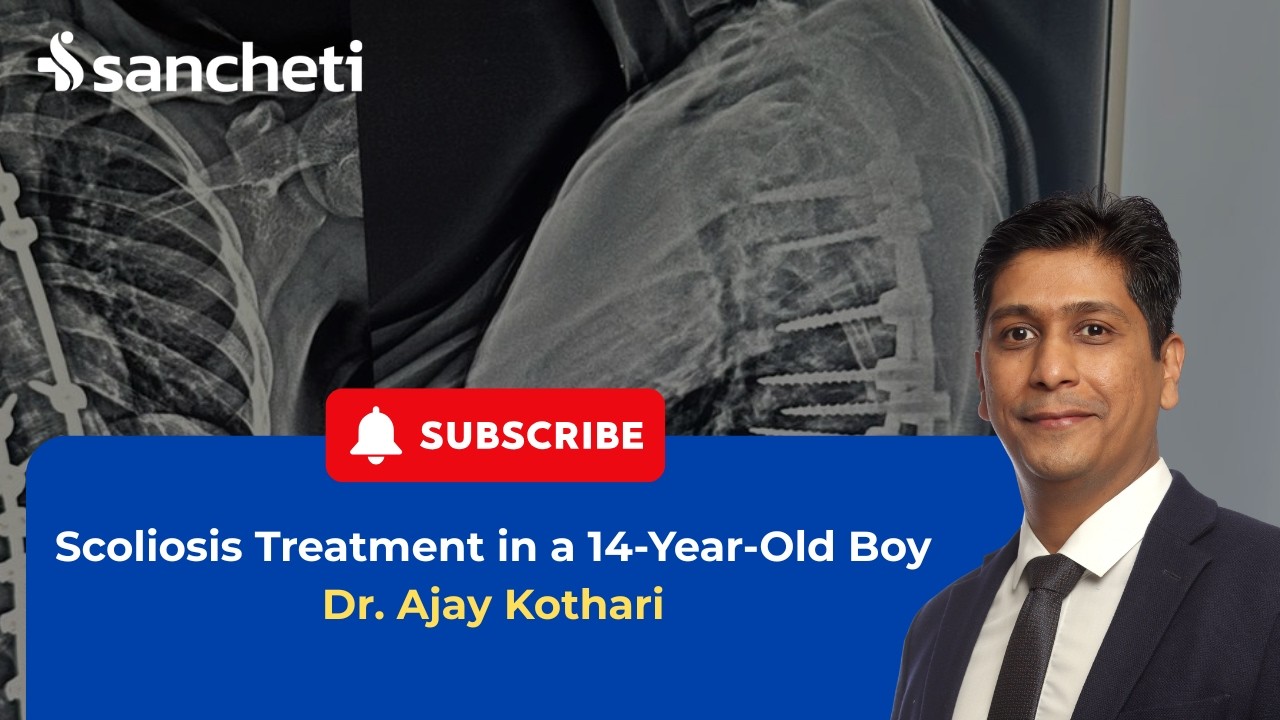 Scoliosis Treatment in a 14-Year-Old Boy | Dr. Ajay Kothari