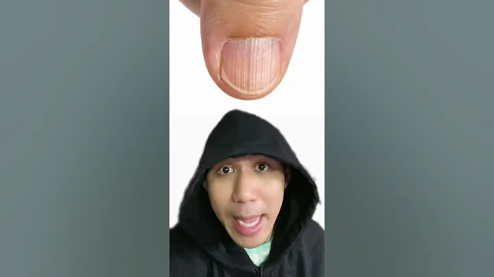 Nhìn Móng Tay Đoán Bệnh | Điều Thú Vị Có Thể Bạn Chưa Biết | Davo's Lingo #shorts