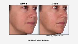 Skinn Cosmetics Divine Elixir Luminous Manuka Oil   Face... screenshot 4