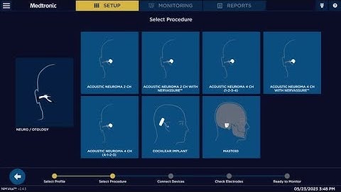 NIM Vital™ nerve monitoring system Set-Up -  Mastoid procedure