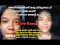Rice facial for skin whitening | Pigmentation,Darkspots,Acnescar,etc... | 100% Result