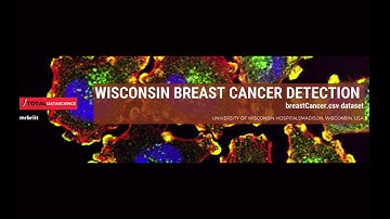 Data science projects-(Dataset Summary)-Breast Cancer Detection using SVM and KNN