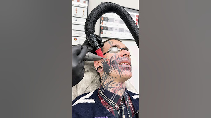 😱ШОК. Зачем он это сделал с собой !? УДАЛЯЕТ ТАТУ НА ЛИЦЕ. часть #2😰. #tattoo #рекомендации #топ #1k