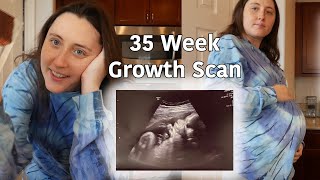 35 Week Growth Scan for our Baby! | Pregnancy Vlog - 3rd Trimester