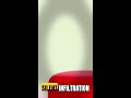 HIV's Backdoor vs Your Immune System — The Infiltration Is Silent #Shorts