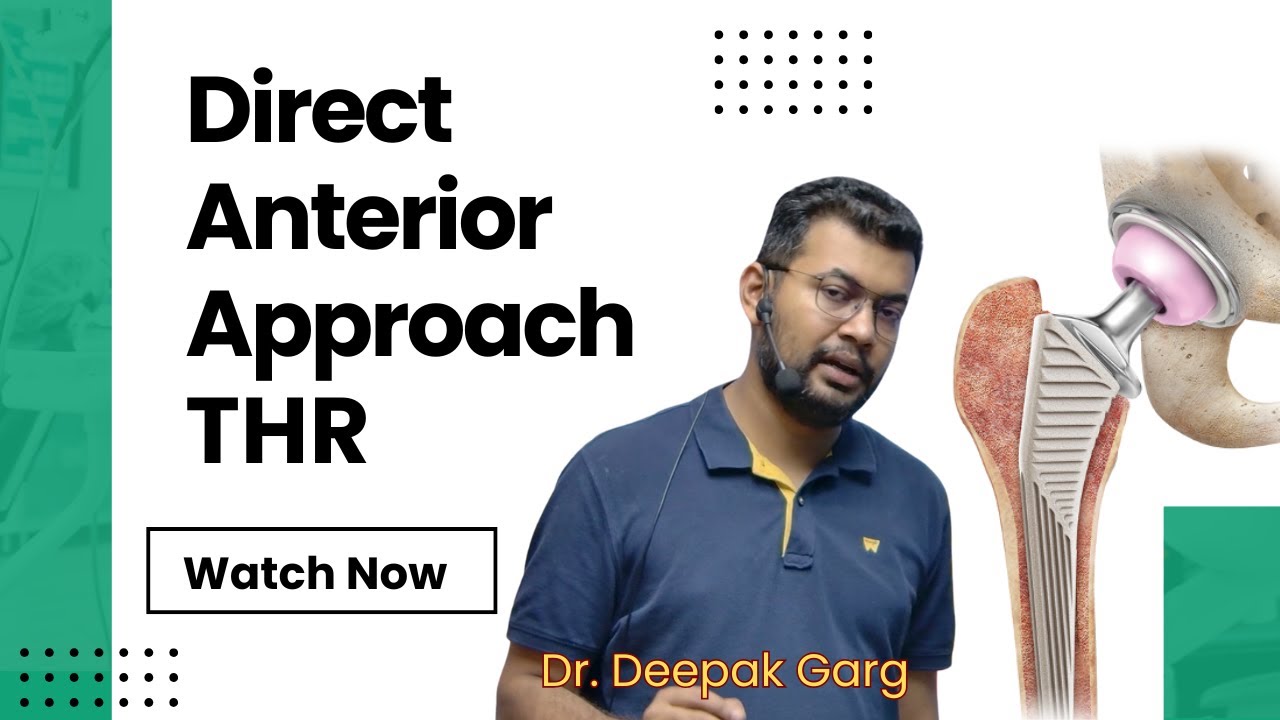 Direct Anterior Approach Total Hip Replacement | Step-by-Step Surgical Technique Explained