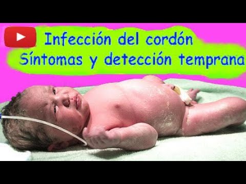 Vídeo: Cordón Umbilical Infectado: Imágenes, Síntomas, Tratamiento, Prevención