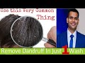 1 Wash And Dandruff Is Gone | Remove Dandruff In One Wash Permanently | Dr. Vivek Joshi