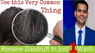 1 Wash And Dandruff Is Gone | Remove Dandruff In One Wash Permanently | Dr. Vivek Joshi