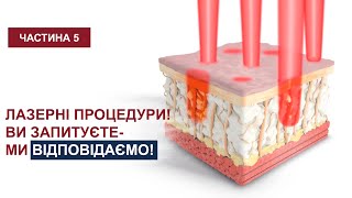 Лазерні процедури! Ви запитуєте - ми відповідаємо! Частина 5.