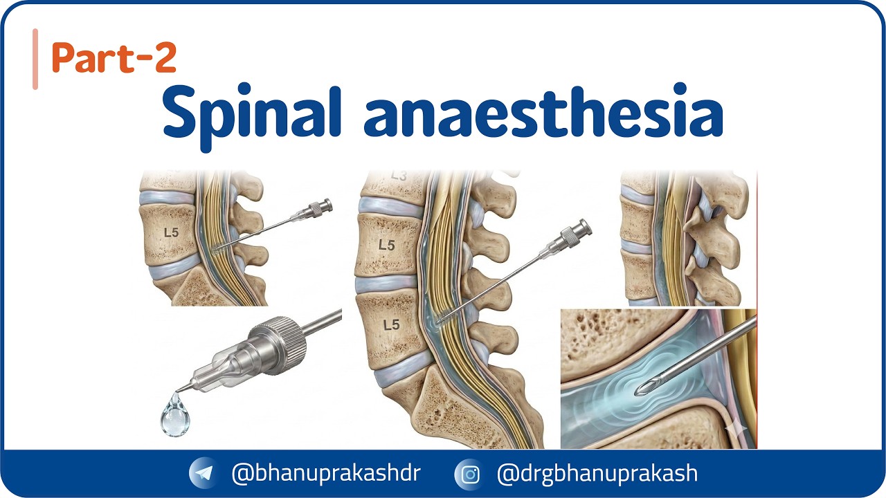 6. Спинальная анестезия (Часть 2): Осложнения, лечение, осложнения
