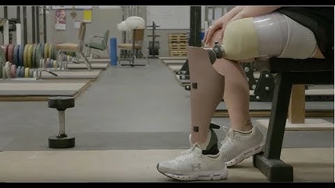 Groundbreaking Osseointegration Developments
