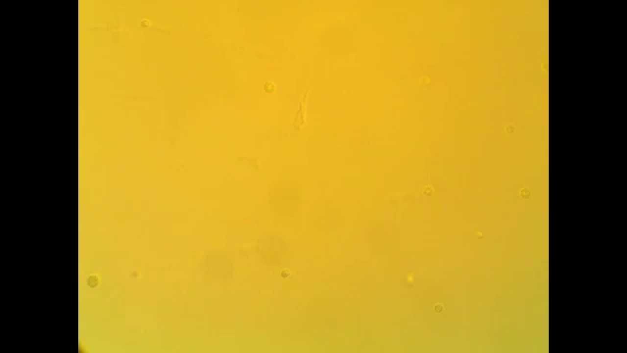 Wild Type Chlamydomonas reinhardtii Swimming (400X magnification)