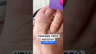 Заказать Микозоцид можно на Wildberries.Артикул - 450824076
