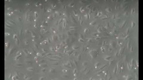 Inflammation - Asthma / COPD:  Eosinophil Adhesion to HMVEC-L at 0.5 dyne/cm²