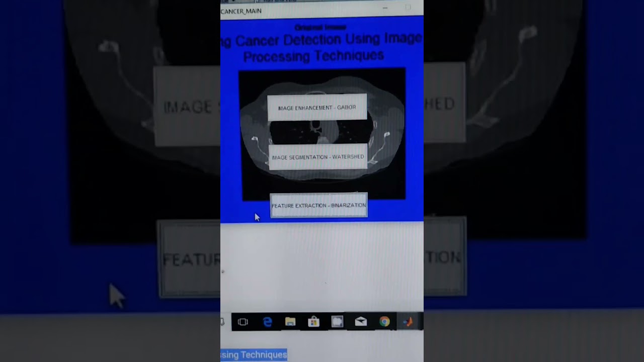 Lung Cancer Detection Using Image Processing Techniques