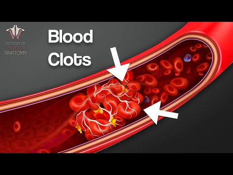 Video: Under blodkoagulering produceras fibrin av?