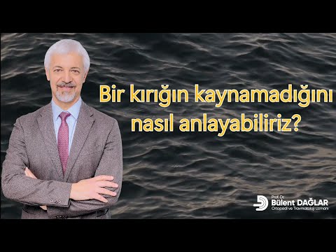 Kırıkların kaynayıp kaynamadığını nasıl anlarız?