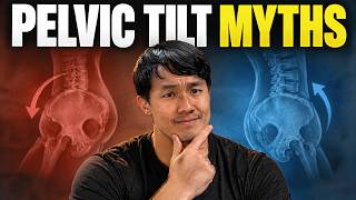 The Truth About Anterior Pelvic Tilt and Pain