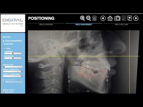 DSS - Orthodontics Tools