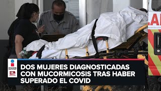 Dos casos de hongo negro en Guerrero