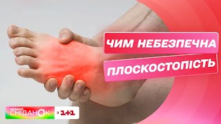 Чим небезпечна плоскостопість і чи можливо її вилікувати - ортопед Олег Левченко