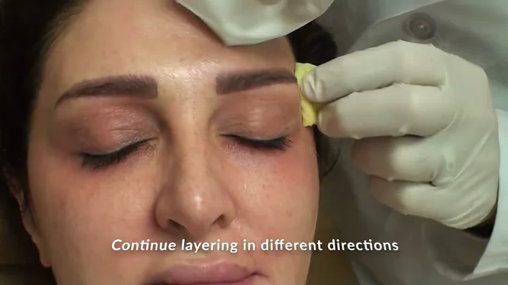 3 Step Peel - ZO Facial Peels