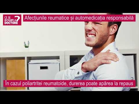 Video: Implicarea Vasculară în Bolile Reumatice: „reumatologie Vasculară”