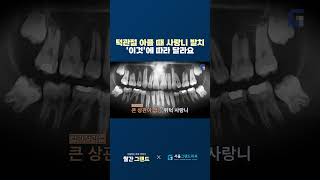 턱관절 아플 때 사랑니 발치, &#39;이것&#39;에 따라 달라요 #서울그랜드치과