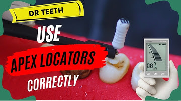 How does Apex Locators work? Let