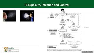 3 Video Overview Latent Tb Infection