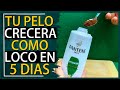 Potencia tu Shampoo con Café y Azúcar: Logra un Cabello Brillante y Fuerte