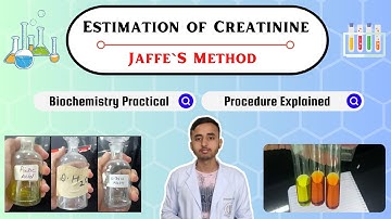 Estimation of Serum Creatinine By Jaffe